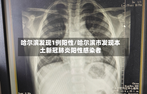 哈尔滨发现1例阳性/哈尔滨市发现本土新冠肺炎阳性感染者-第1张图片