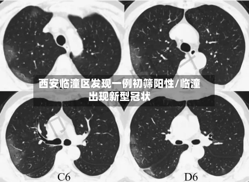 西安临潼区发现一例初筛阳性/临潼出现新型冠状-第1张图片