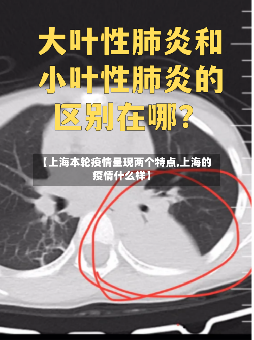 【上海本轮疫情呈现两个特点,上海的疫情什么样】-第1张图片