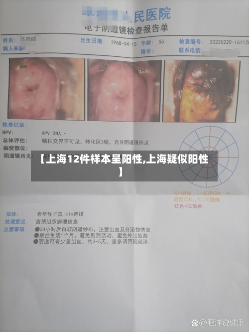 【上海12件样本呈阳性,上海疑似阳性】-第1张图片