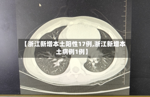 【浙江新增本土阳性17例,浙江新增本土病例1例】-第1张图片